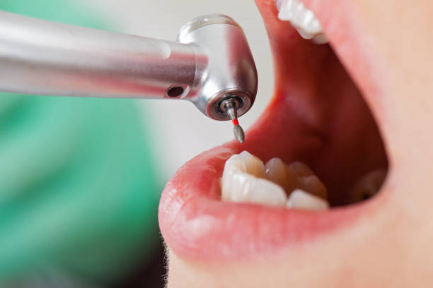 Best Cosmetic Emergency Dentistry in Buena Vista, VA